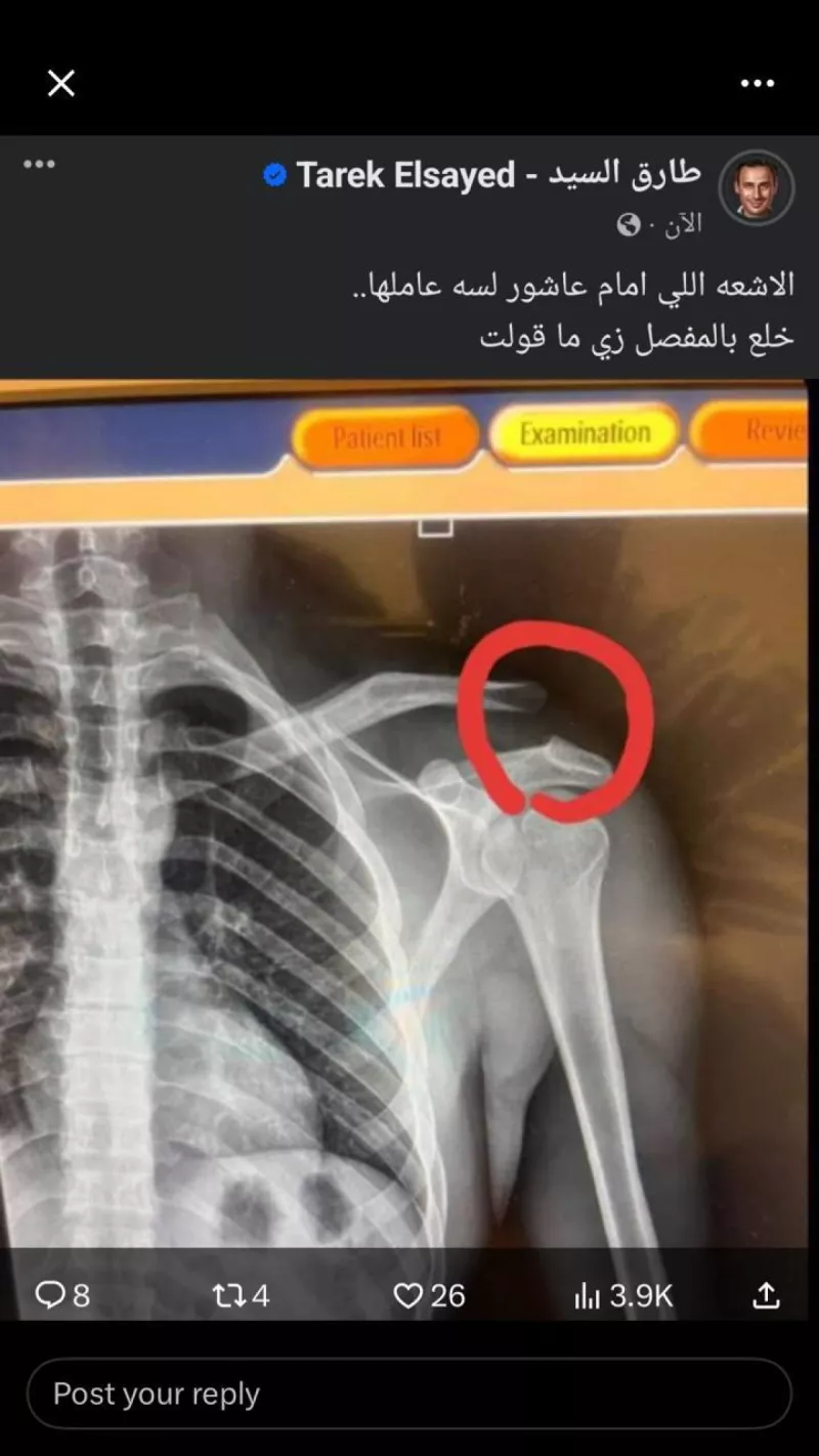 إمام عاشور إمام عاشور